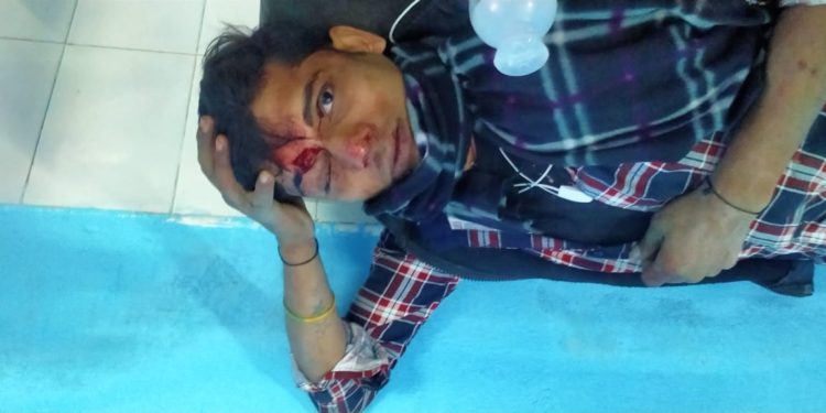 नशे की हालत में बुरी तरह जख्मी हुआ बाइक सवार शराबी युवक,थानाध्यक्ष को सूचना दिए जाने के बाद भी इलाजरत युवक पीएचसी से हुआ फरार,चर्चाओं का बाजार गर्म।।*