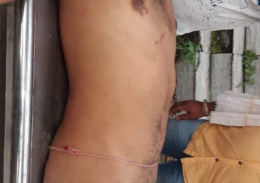 महज एक कमरे के लिए खून के प्यासे हो चले चाचा-भतीजे ने गोली मार कर ले ली एक दूसरे की जान,मचा कोहराम,पड़ताल में जुटी पुलिस