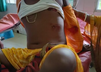 धीमी गति से बाइक ड्राइव करने की नसीहत देना व्यवसायी को पड़ा मंहगा, बदमाशों ने ठोंक दी गोली