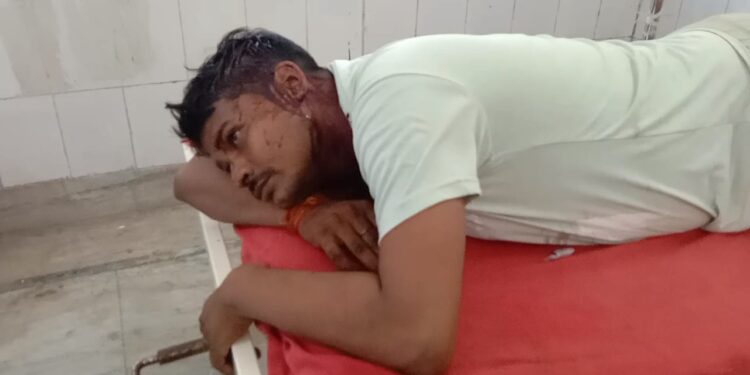 दो भाईयों के बीच हुई जमकर मारपीट,दोनों जख्मी भाईयों का इलाज जारी