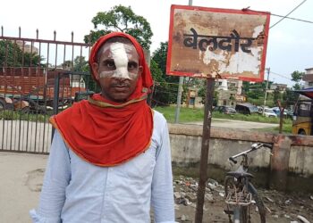 जमीनी विवाद को ले दबंगों ने युवक पर किया जानलेवा हमला,नाक का हड्डी भी तोड़ा,मामला दर्ज कर छानबीन में जुटी पुलिस