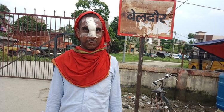 जमीनी विवाद को ले दबंगों ने युवक पर किया जानलेवा हमला,नाक का हड्डी भी तोड़ा,मामला दर्ज कर छानबीन में जुटी पुलिस