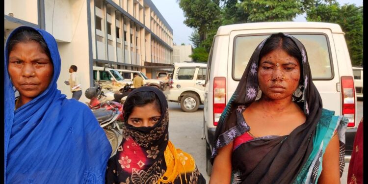 दरिंदे ने घर में घुसकर सुप्तावस्था में युवती को बनाना चाहा हवश का शिकार,शोर सुनकर पहुंची युवती की मां पर मनचले ने चला दी गोली,बाल-बाल बची महिला,लेकिन बारुद से झुलसा चेहरा