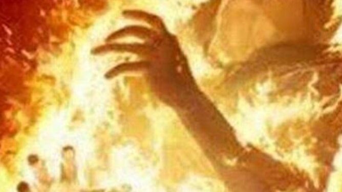 शराब के नशे में सनकी पिता ने चार साल की मासूम बेटी को घर में बंद कर जिंदा जलाया,हालत नाजुक