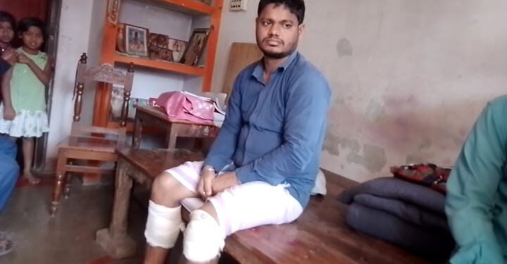 होली के दिन दुकानदार ने कपड़े नहीं दिए उधार तो अपराधियों ने की गोलीबारी,दुकानदार के पैर में लगी गोली,अपराधियों के तलाश में जुटी पुलिस