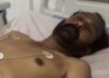 छिनतई के दौरान बाइक सवार अपराधियों ने प्रॉपर्टी डीलर को मारी गोली,हालत गंभीर