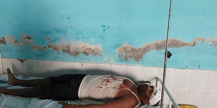 जमीनी विवाद को लेकर आखिर कब तक सुलगता रहेगा बेलदौर प्रखंड क्षेत्र का विभिन्न इलाका!दबंगों ने पति-पत्नी को मारपीट कर किया बुरी तरह जख्मी